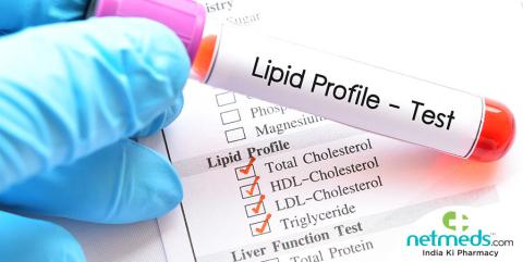 Cholesterol and lipid tests